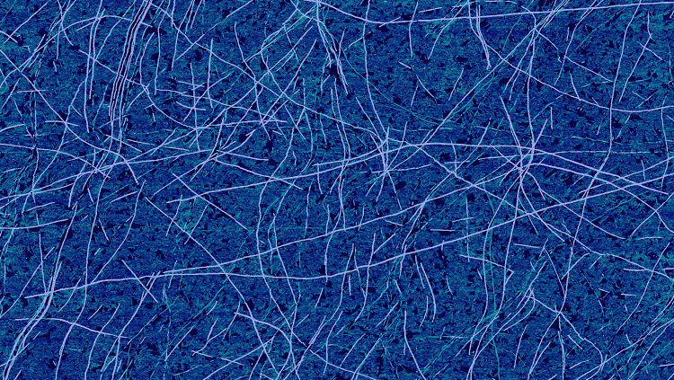 Image of amyloid fibrils seen in a lab sample created on mica