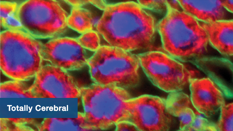 Totally Cerebral Collection Thumbnail