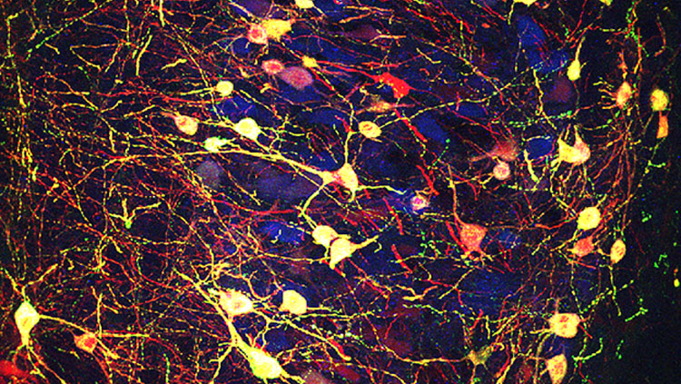 A group of midbrain neurons expressing acetylcholine (blue) are made to express another type of neurotransmitter, glutamate (green), using adeno-associated virus as a gene delivery platform. The neurons targeted by the virus also express a red fluorescent protein for identification and thus appear a light-yellow color (green plus red and blue).