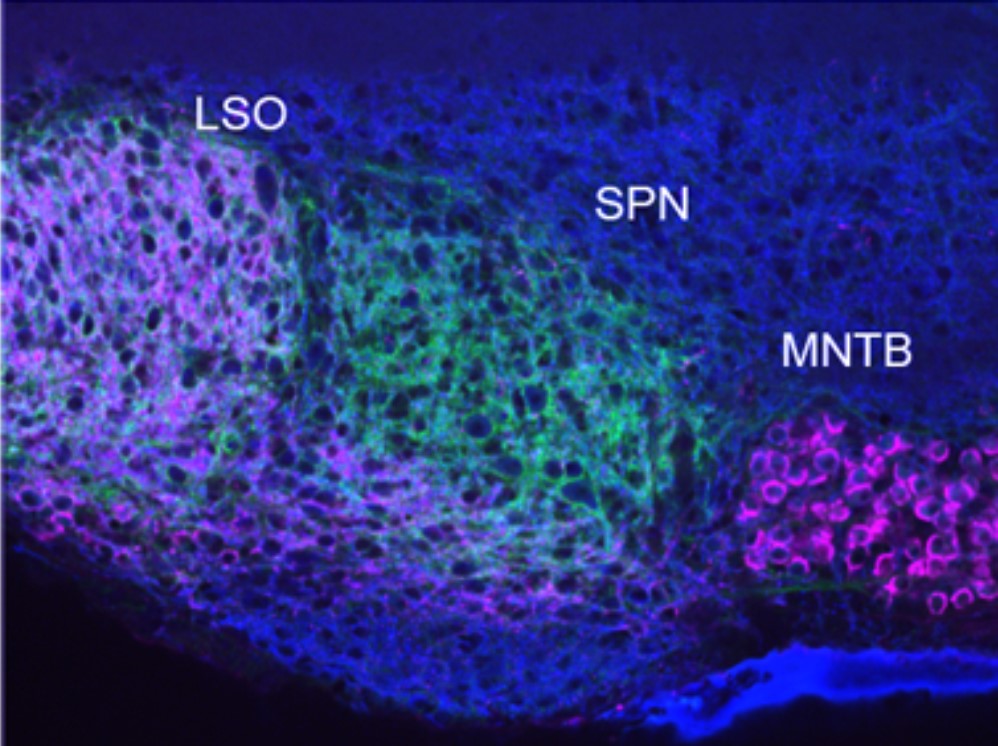 Histochemical profile of excitatory (magenta) and inhibitory (green) inputs to the superior paraolivary nucleus (SPN). (Figure provided by Rajaram et al., 2019, eNeuro.)