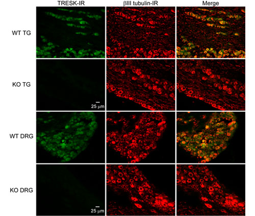Representative images of TG and DRG sections from adult WT and TRESK KO mice double stained with antibodies against TRESK and βIII tubulin. βIII tubulin-IR is present in all neurons. TRESK-IR is present in almost all neurons in the WT sections. There is no TRESK-IR in the KO sections. Adapted from Figure 1, Guo et al., eNeuro, 2019.