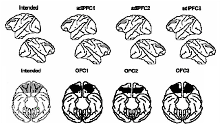 Lesion histology.