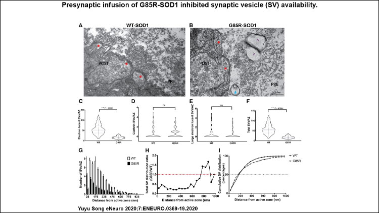 Presynaptic infusion of G85R-SOD1 inhibited synaptic vesicle (SV) availability. Representative EM images illustrate morphology of AZs (labeled with red *) and numbers of SVs in fixed synapses infused with WT-SOD1 and G85R-SOD1.