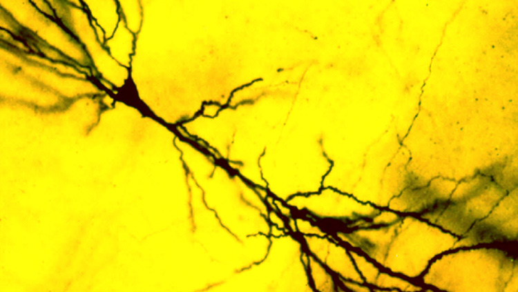 This image shows a single CA1 pyramidal cell from hippocampal area CA1 in adult rat, stained using the rapid Golgi technique. The image served as the frontispiece of Kristen Harris’ 1982 PhD thesis. It also hangs in the Boston Museum of Science. 