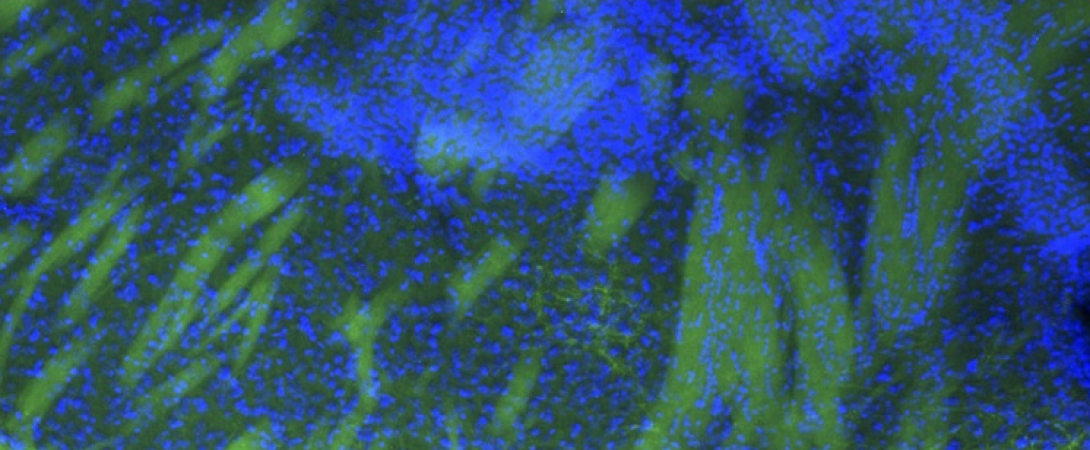 This image shows corticofugal axons (green) projecting from layer 5 of the mouse primary visual cortex to the dorsal striatum. Layer 5 projections from primary visual, primary somatosensory, primary motor, and ventromedial orbitofrontal cortex all have terminal fields within the striatum, among other common targets. Blue is DAPi nuclear stain.