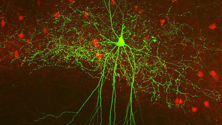 This image shows a parvalbuminexpressing inhibitory basket cell (green) in the hippocampus of an amyloid-depositing 5xFAD mouse. The cell has been morphologically reconstructed after patch clamp recording of spontaneous synaptic activity during sharp wave ripple events. Non-patched parvalbumin neurons are labeled in red.  