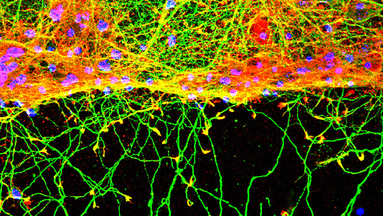 This image shows neurite outgrowth by cultured mouse neurons 16 hours after a scrape wound was made with a pipette tip. Neurite outgrowth is enhanced by soluble SORLA. 