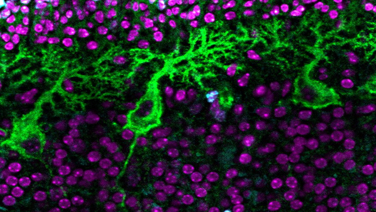 This picture shows Purkinje cells (green), proliferating cells (cyan), and cell nuclei (purple) in a postnatal day 7 mouse cerebellum. The p75 neurotrophin receptor promotes cell-cycle exit by proliferating cerebellar granule cell precursors. Loss of this receptor prolongs granule cell precursor proliferation, resulting in increased glutamatergic input to Purkinje cells and deficits cerebellum dependent learning.  