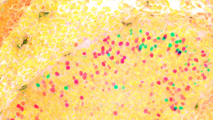 This confocal image shows a fluorescently labeled mouse vomeronasal organ at embryonic day 13.5. The developing vomeronasal organ is composed of two distinct neuronal types that can be distinguished based on the expression of the specific transcription factors AP-2ε(cyan) and Meis2 (magenta).