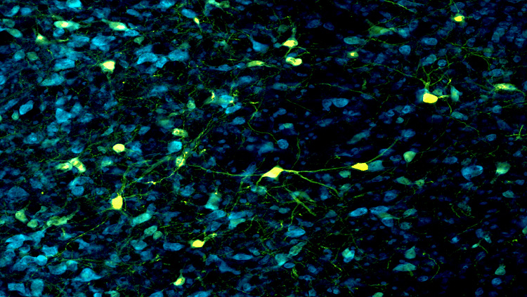 This image shows ventral striatal neurons from a rodent brain. The cell bodies are stained in blue using a fluorescent NISSL stain (NeuroTrace). A light sensitive virus for optogenetics was transducted into neurons shown in yellow. Neurons in this area are involved in scaling fear to the degree of threat and in rapid discrimination of uncertain threat and safety.  