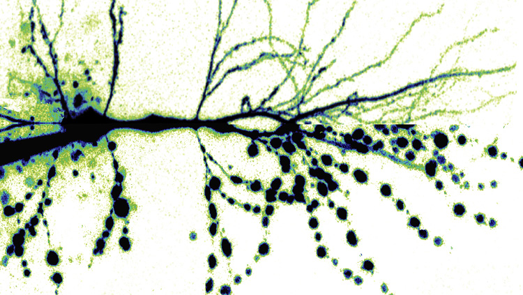 This mirrored image shows a CA1 neuron before (left side) and after (right side) activation of excitotoxicity by metabotropic NMDA receptors and pannexin-1, a postsynaptic ion and metabolite channel. Metabotropic NMDAR signaling regulates pannexin-1 through Src kinase. This pathway suppresses facilitated release of presynaptic glutamate during synaptic activity by regulating tissue levels of the TRPV1 agonist anandamide. 