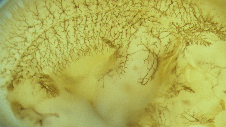 This image shows an embryonic day 12.5 mouse embryo lacking the Plexin-A4 receptor. These mice develop exuberant cutaneous sensory axonal projections, as revealed by anti-Neurofilament staining.