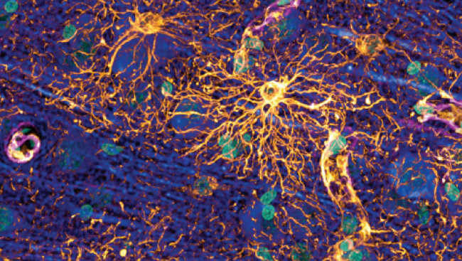 Neuron Specific Endosomal Regulators Of Excitatory Synaptic Neurotransmission And Synapse Stability Neuron Specific Endosomal Regulators Of Excitatory Synaptic Neurotransmission And Synapse Stability