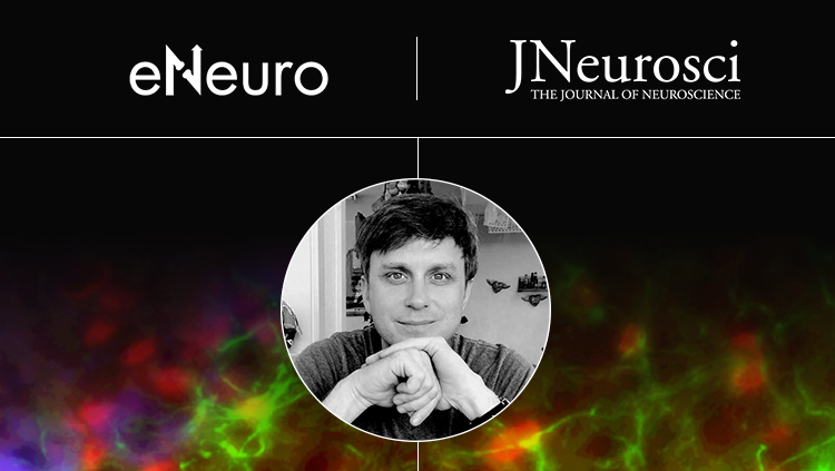 An Open-Source 3D Printable thumbnail