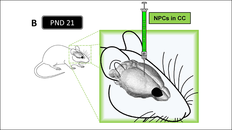 Mouse Study Supports Stem Cell Therapy for Cerebral Palsy