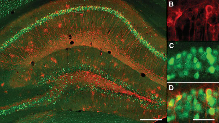 Hippocampal LacZ and cFos staining of a TetTag mouse. A, Fluorescent micrographs of dorsal hippocampal CA1 neurons that were stained for LacZ (red) and cFos (green). Part of the CA1 (dotted line square) was enlarged to show LacZ (B), cFos (C), and the overlapping of LacZ and cFos in engram cells (D). Scale bars: A, 250 μm; B–D, 40 μm.