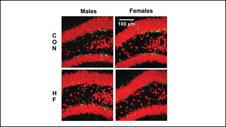 High Fat Diet Impairs New Neuron Growth in Female Mice
