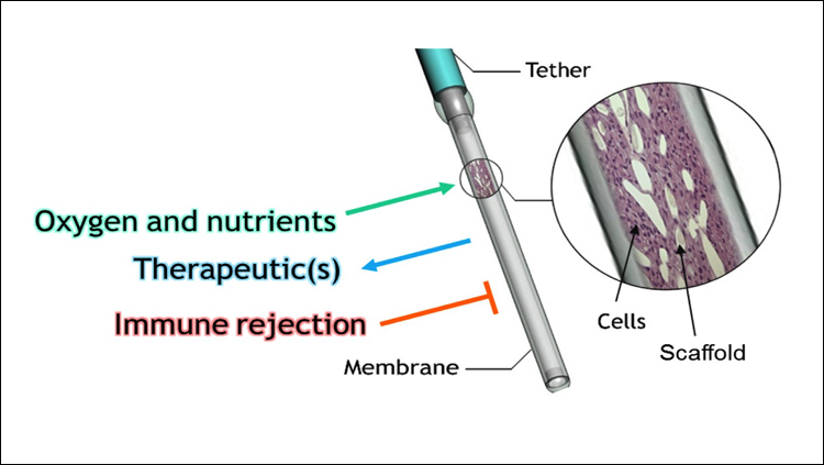 Implantable Device Curbs Seizures and Improves Cognition in Epileptic Rats